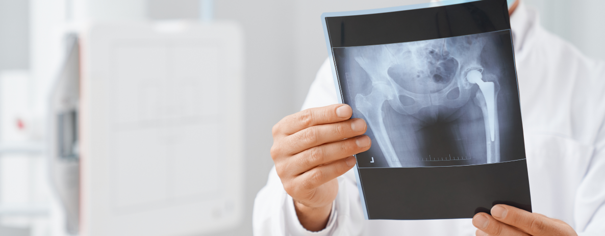 ortopedista-de-quadril-not-ortopedia-blog-1.png